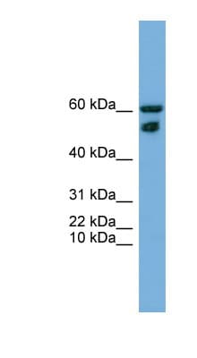 ZNF765 Antibody (N-Terminus)
