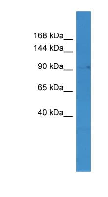 MLXIP / MONDOA Antibody (C-Terminus)