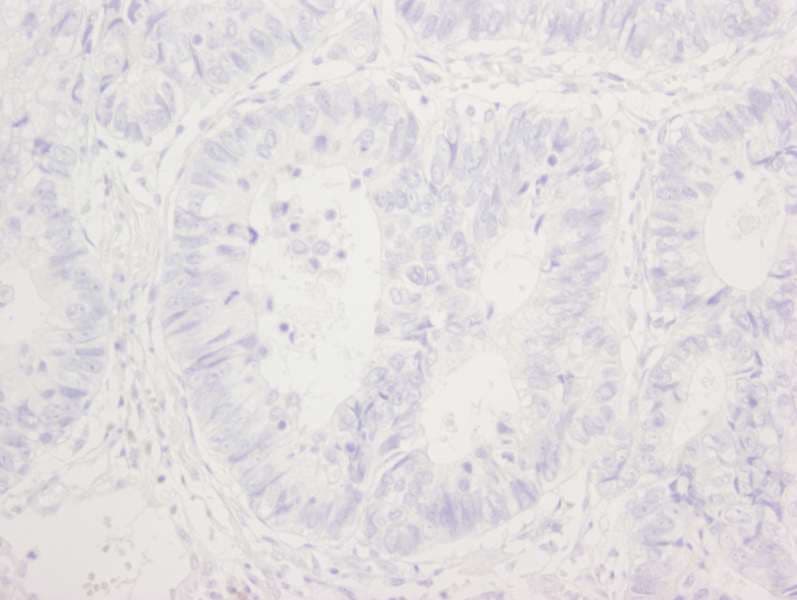 TP53BP1 / 53BP1 Antibody (phospho-Ser25)