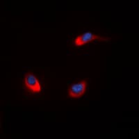 Polyclonal Rabbit anti-Human EMA / MUC1 Antibody (C-Terminus, IHC, IF, WB)