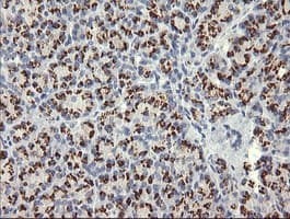 NKIRAS1 Antibody (clone OTI8B11)