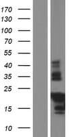 TMIE Protein (Over-Expression Lysate Myc-DDK (Flag))