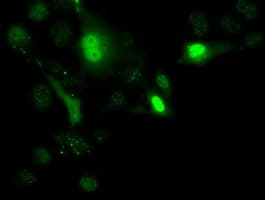Monoclonal Mouse anti-Human UCK1 Antibody (clone OTI4C2, IF, WB)