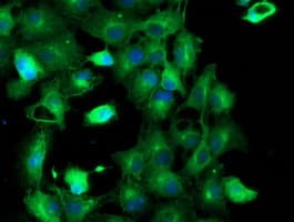 TUBAL3 Antibody (aa150-446, clone OTI2F6, Carrier-free)