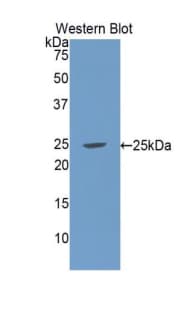 GC1qR / C1QBP Antibody (aa76-282)