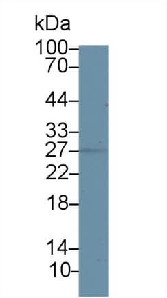 HSD17B10 / HADH2 Antibody (aa4-202, PE)