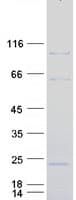 Human DZIP1L Protein (Recombinant Myc-DDK (Flag))