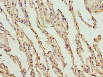 Polyclonal Rabbit anti-Human NANOS3 / NOS-3 Antibody (WB)