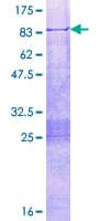 Human TEAD2 Protein (Recombinant GST)