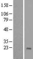 ZNF576 Protein (Over-Expression Lysate Myc-DDK (Flag))