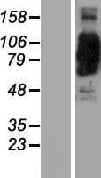 Coronin 7 / CORO7 Protein (Over-Expression Lysate Myc-DDK (Flag))