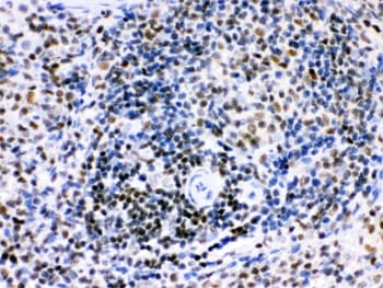 IKZF1 / IKAROS Antibody