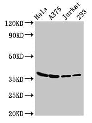 LDHA / LDH1 Antibody