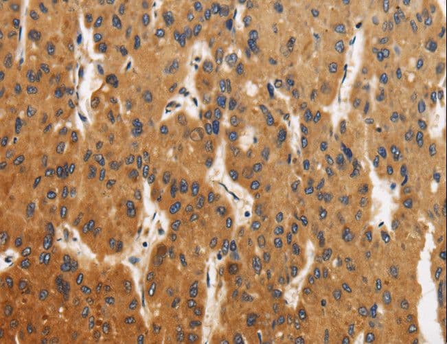 Polyclonal Rabbit anti-Human CALU / Calumenin Antibody (IHC, WB)