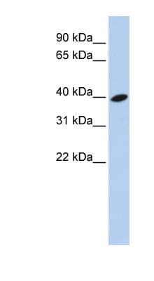 Polyclonal Rabbit anti-Human ARL13B Antibody (aa252-301, WB)