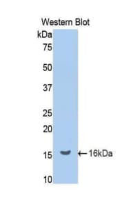 REN / Renin 1 Antibody (aa265-386)