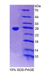 Human FTH1 / Ferritin Heavy Chain Protein (Recombinant His-T7)