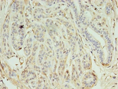 KEAP1 Antibody