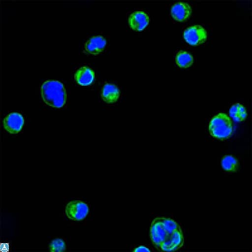 ITGB2 / CD18 Antibody