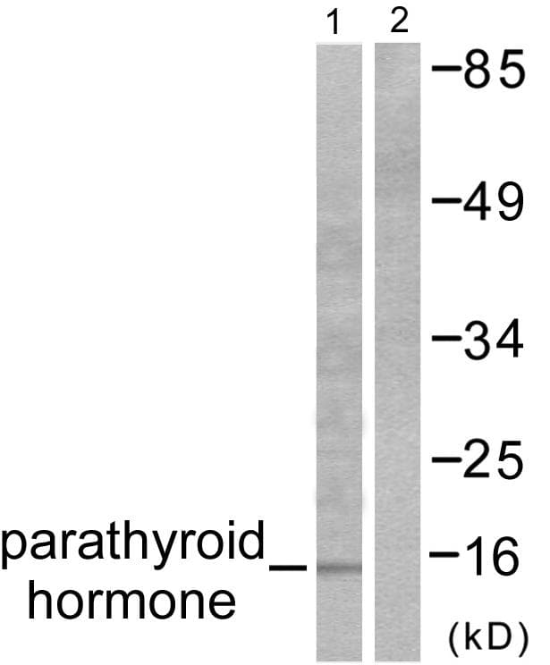 PTH / Parathyroid Hormone Antibody