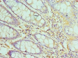 TFDP1 Antibody (aa1-290)