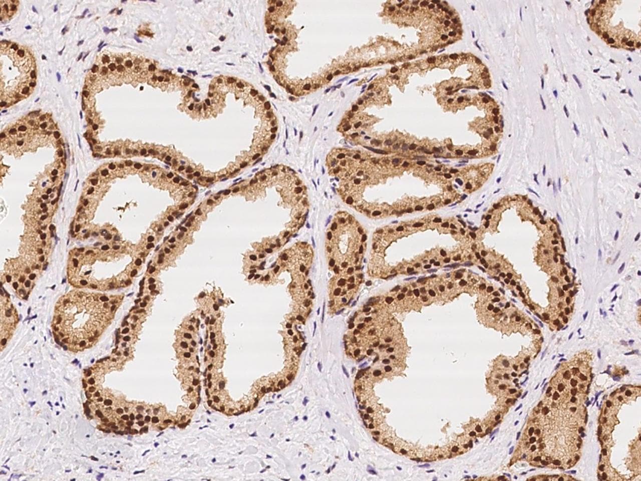 Polyclonal Rabbit anti-Human PRMT5 Antibody (Preservative Free, IHC)