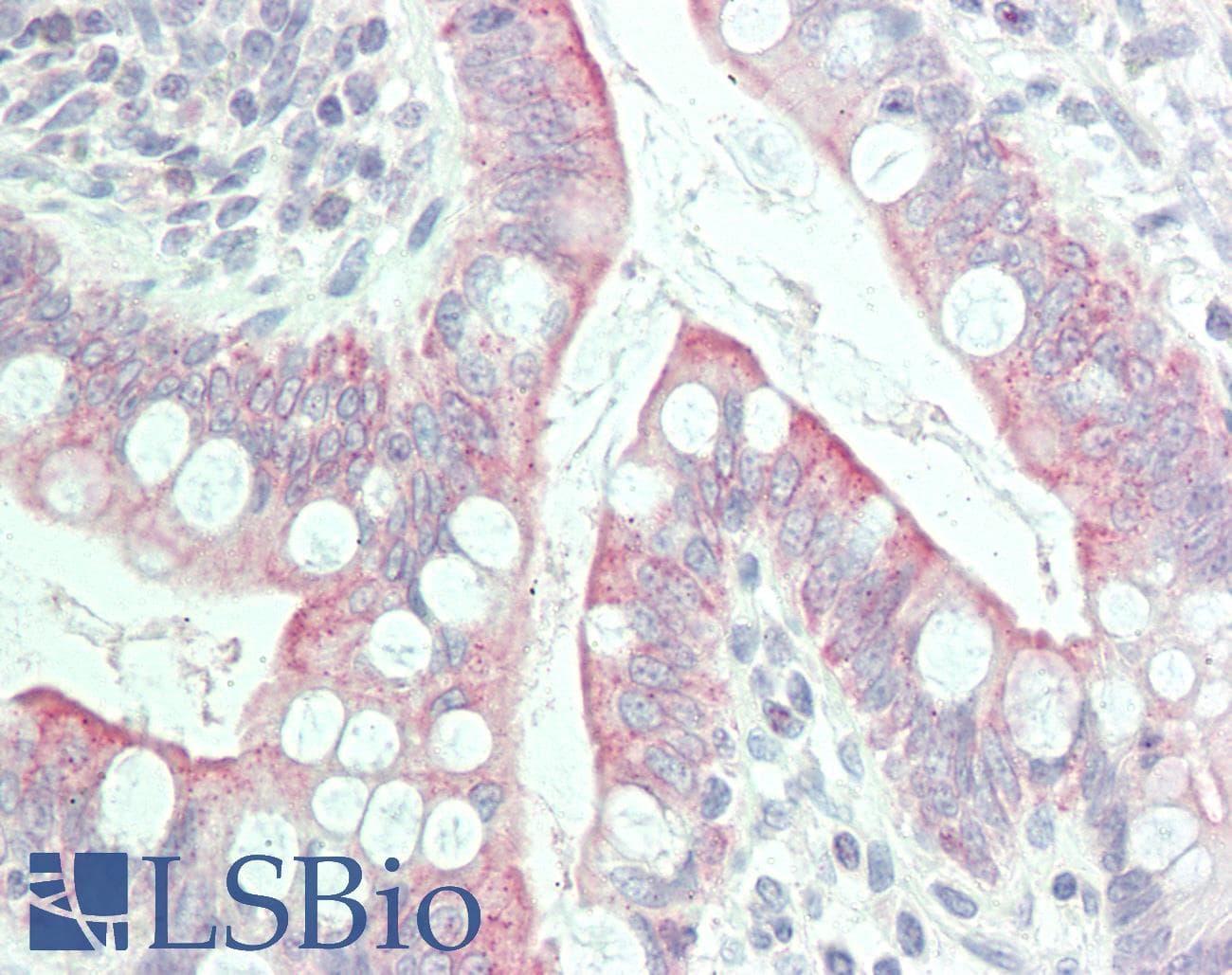 IHC-plus™ GPR31 Antibody (N-Terminus)