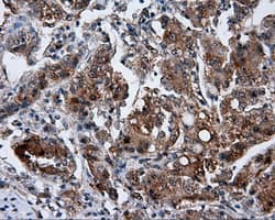 GBE1 Antibody (clone OTI3B4)