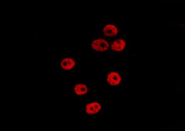 Polyclonal Rabbit anti-Human OGFR Antibody (IF, WB)