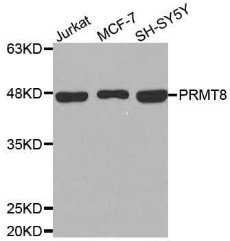 PRMT8 Antibody