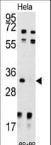 UCK2 Antibody (aa1-30)