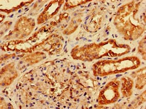 AGPAT3 Antibody