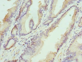 Polyclonal Rabbit anti-Human HAPLN1 Antibody (IHC)