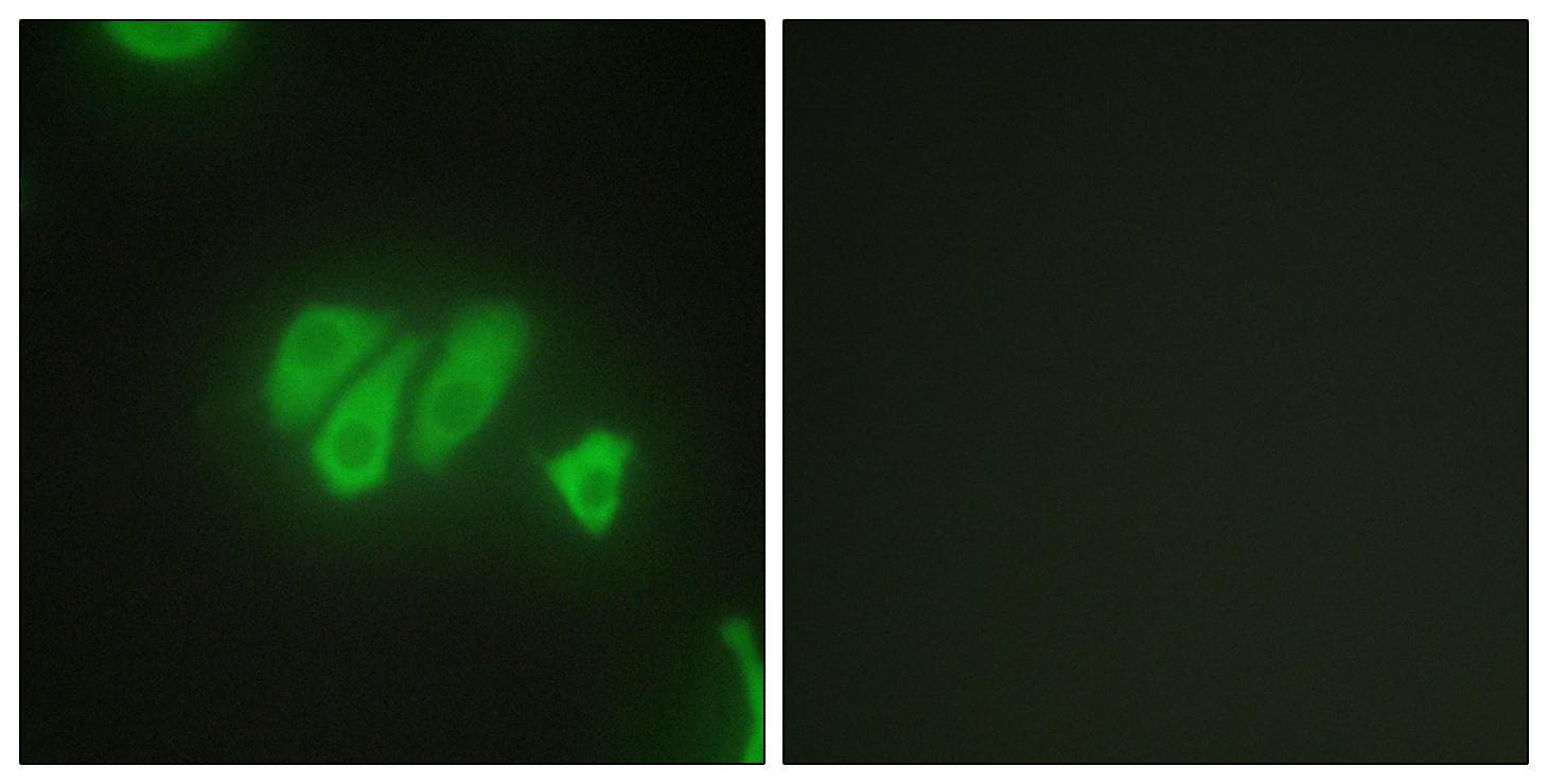 PDZD2 Antibody