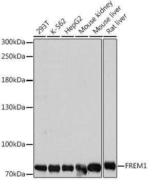 Polyclonal Rabbit anti-Human FREM1 Antibody (WB)
