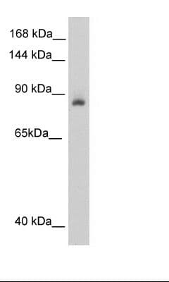 Polyclonal Rabbit anti-Human ACO1 / Aconitase Antibody (N-Terminus, IHC, WB)