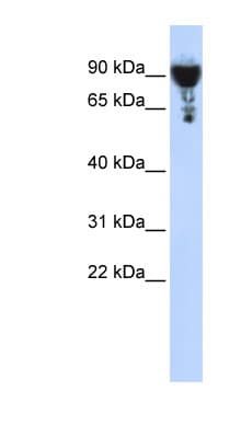 Polyclonal Rabbit anti-Human EXOC3 / SEC6 Antibody (aa252-301, WB)