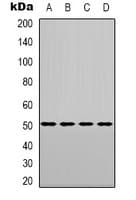 Polyclonal Rabbit anti-Human NR1H3 / LXR Alpha Antibody (Internal, WB)