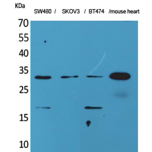 Polyclonal Rabbit anti-Human FGF18 Antibody (C-terminal, WB)