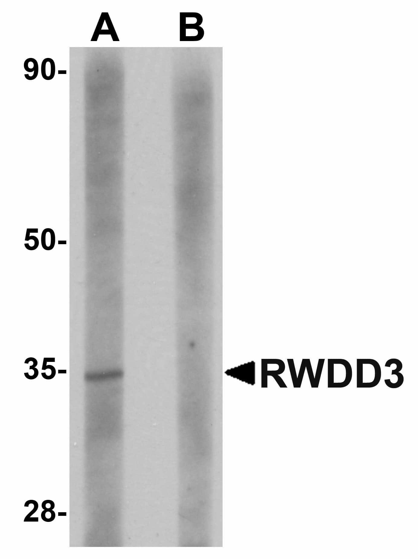 IHC-plus™ RWDD3 Antibody
