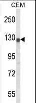 Polyclonal Rabbit anti-Human KCNH2 / HERG Antibody (aa861-888, WB)