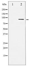 STAT5B Antibody