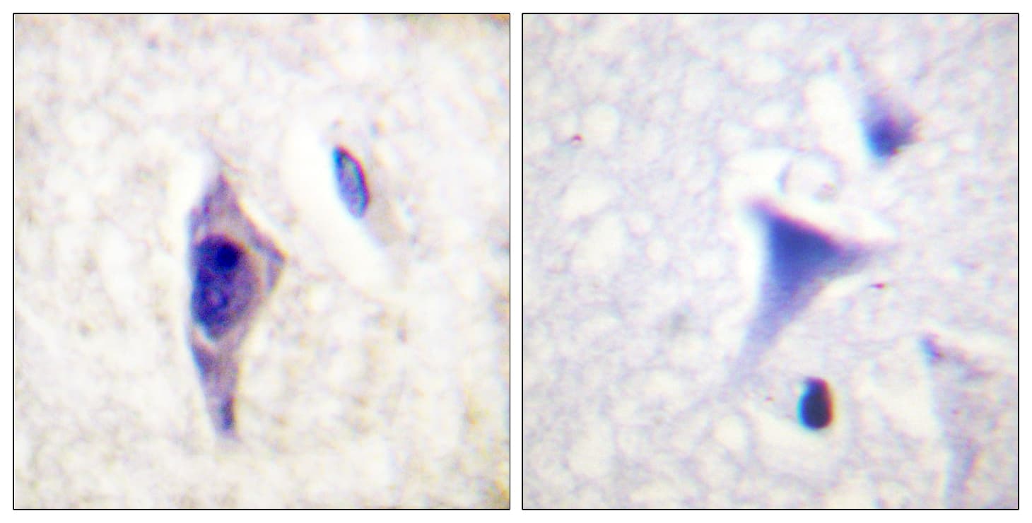 PIK3R1 / p85 Alpha Antibody (phospho-Tyr607)