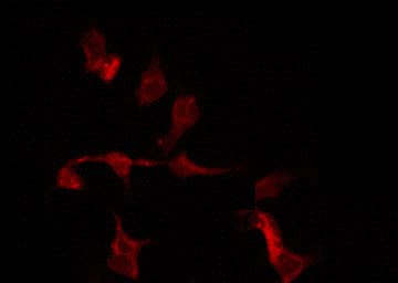 HMG2 / HMGB2 Antibody