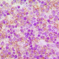 Polyclonal Rabbit anti-Human CDC25A Antibody (phospho-Ser75, IHC, WB)