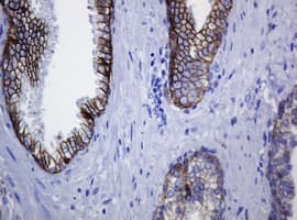 Monoclonal Mouse anti-Human CDH1 / E Cadherin Antibody (clone OTI2F9, IHC, WB)