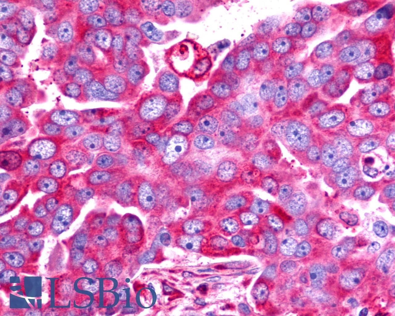 PathPlus™ Polyclonal Rabbit anti-Human TAAR6 Antibody (C-Terminus, IHC)