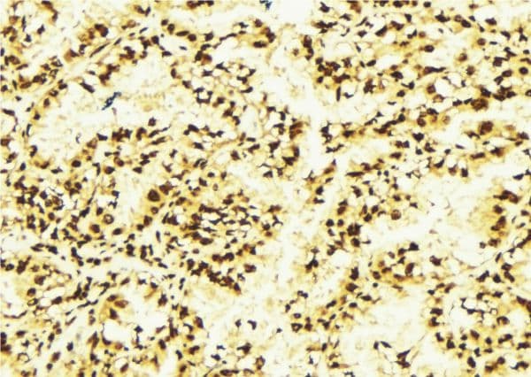 TFCP2 / CP2 Antibody