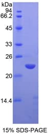 Mouse MMP13 Protein (Recombinant His, N-Terminal)
