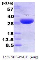 Human HMOX1 / HO-1 Protein (Recombinant His)